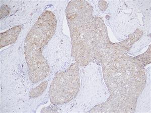 3625A | Control Slides:Immunopathology; p16